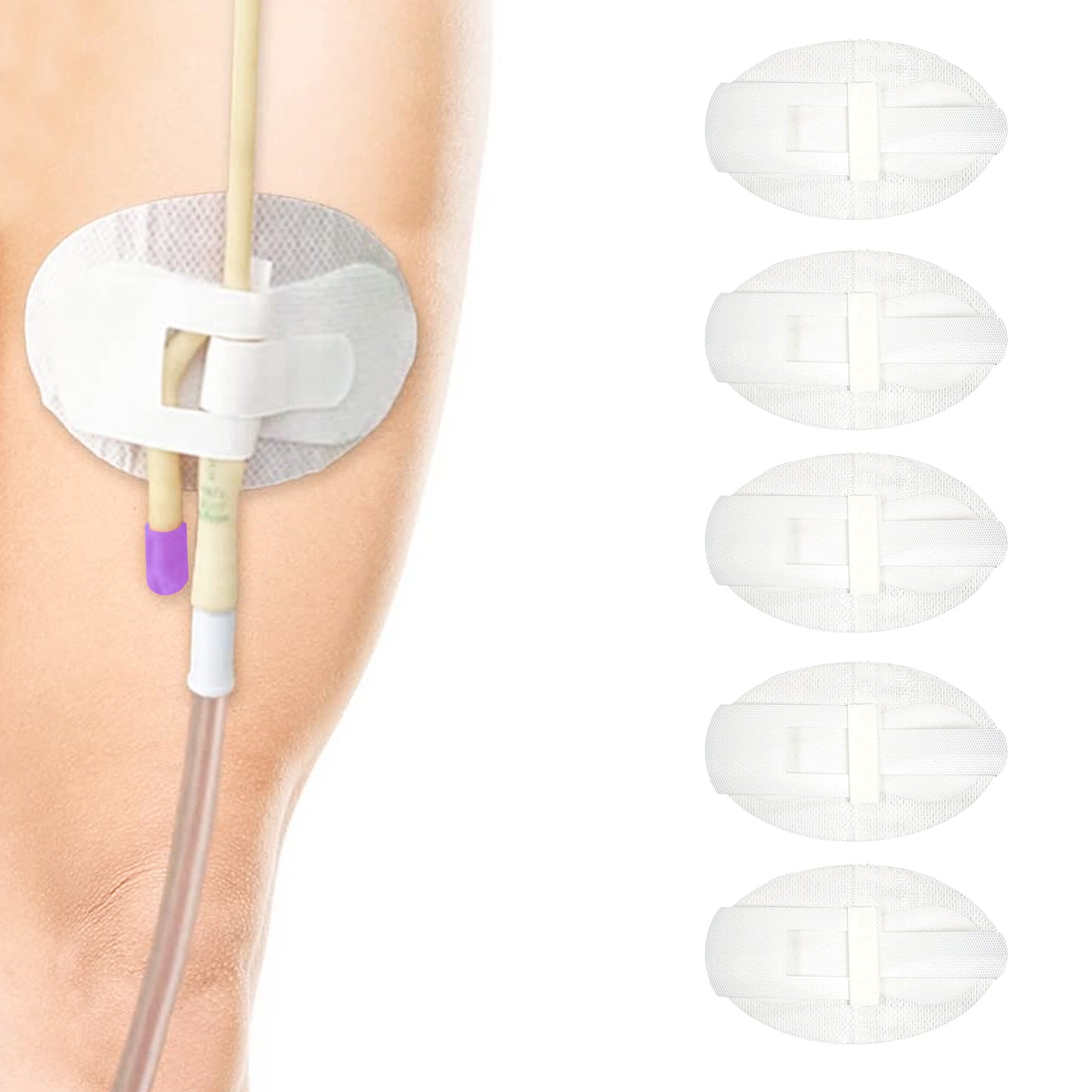 Catheter Stabilization Device,Catheter Urinary Leg Bag Legband Holder Sticker,Statlock Catheter Holder,Adhensive Catheter Leg Strap Hook and Loop,Catheter Supplies