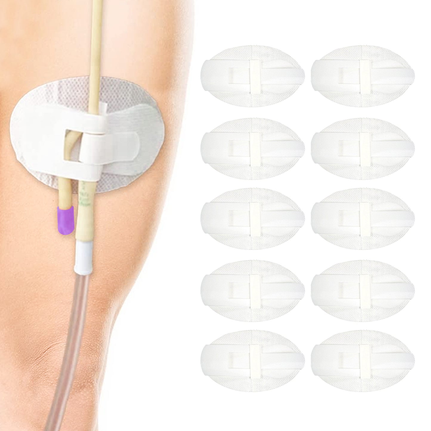 Catheter Stabilization Device,Catheter Urinary Leg Bag Legband Holder Sticker,Statlock Catheter Holder,Adhensive Catheter Leg Strap Hook and Loop,Catheter Supplies