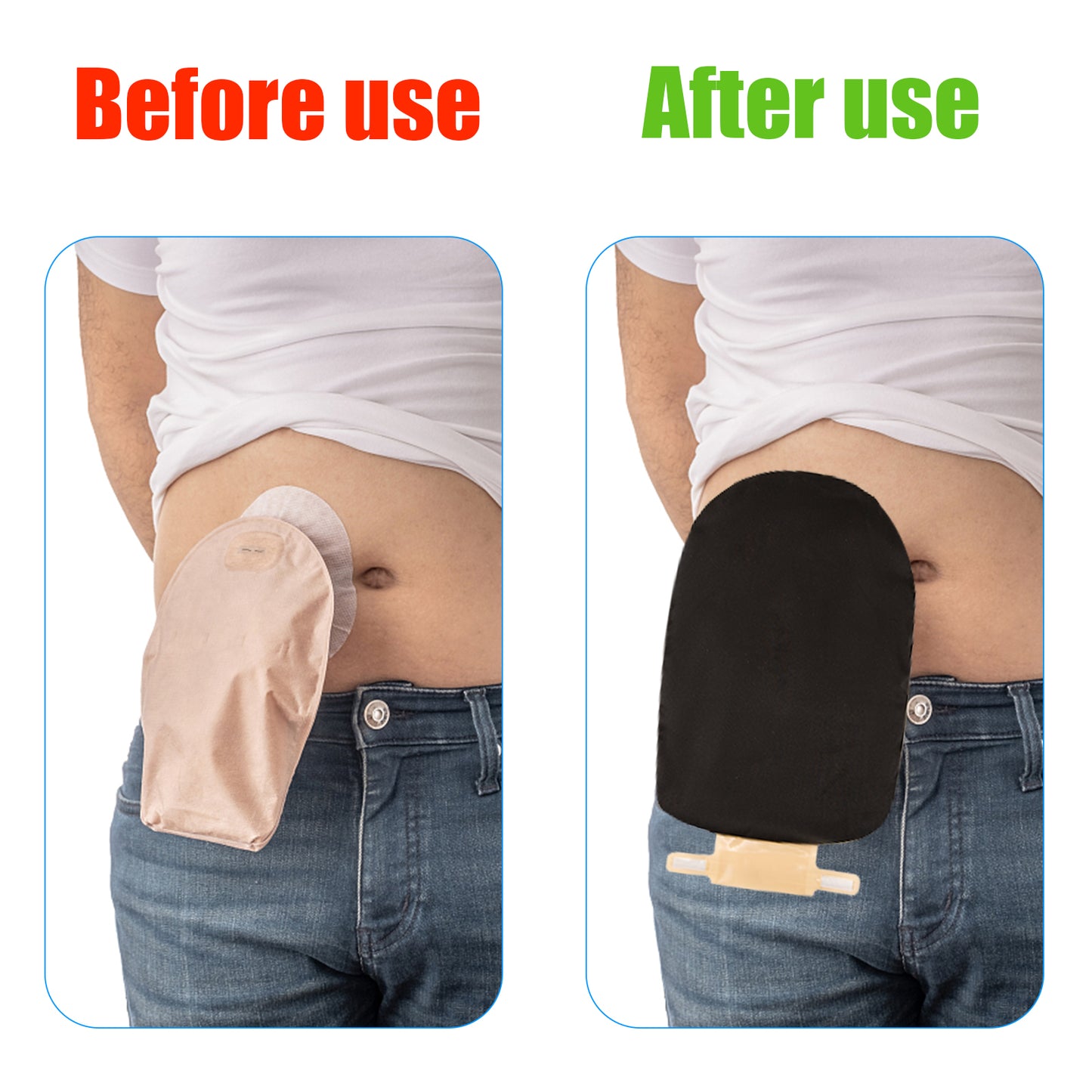 Ostomy Bag Cover,Colostomy Bag Covers,Odor Control Stretchy Bag Cover,Ostomy Wrap,Pouch Liner wih Adjustable Opening for Women Men Protective Bag for Ileostomy,Urostomy,Ostomy Supplies