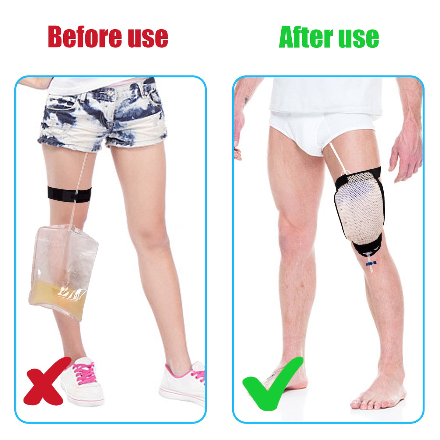 Catheter Leg Bag Holder,Breathable Mesh Catheter Leg Bag,Catheter Stabilization Device Keep Urinary Drainage Bag in Place,Urine Bag for Leg,Foley Catheter Bag Holder,Catheter Sleeves,Catheter Supplies